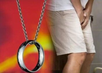 Waduh! Cincin Sangkut di Kelamin Pria Ini, Dilepas Pakai Mesin Potong