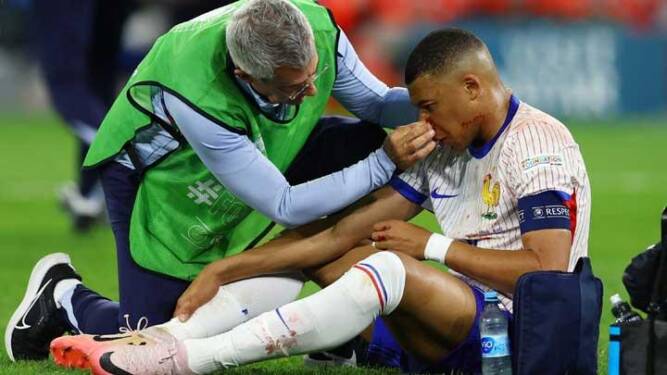 Foto: Penyerang Prancis Kylian Mbappe menerima perawatan medis selama pertandingan sepak bola Grup D UEFA Euro 2024 antara Austria dan Prancis di Duesseldorf Arena di Duesseldorf pada 17 Juni 2024.