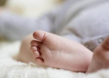Pertama di Dunia, Bayi Ini Lahir dengan 3 Penis
