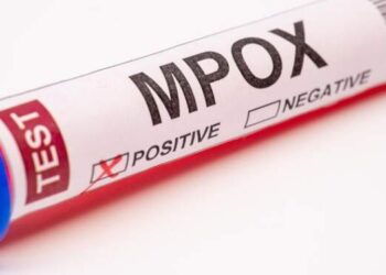 Mengerikan! ‘Cacar Monyet’ Mpox Mengganas di Kongo, 548 Orang Tewas