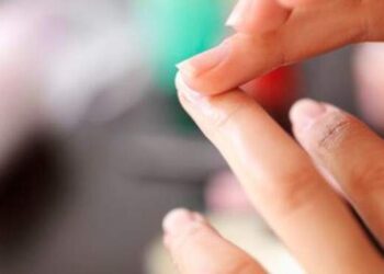 Waspada! Bentuk Kuku Seperti Ini Bisa Jadi Pertanda Kolesterol Tinggi