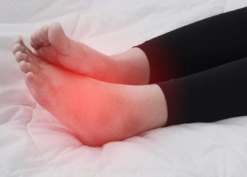 Kaki Bengkak saat Mudik, Ini Penjelasan Dokter