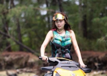 Diseruduk Jetski, Wendy Walters Cidera Kaki dan Leher