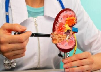 Waspadai Gagal Ginjal di Usia Muda, Ini Penyebabnya