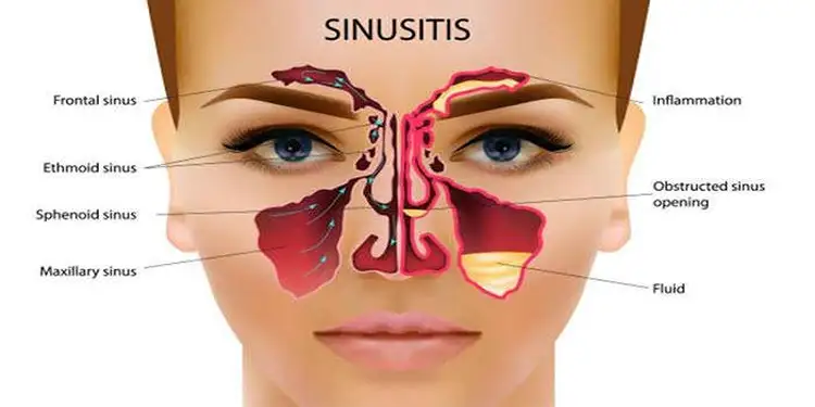 Foto ilustrasi (Photo Source: Bisnis Style)