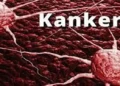 Foto: Daftar Tujuh Kebiasaan Sepele yang Dapat Meningkatkan Risiko Kanker Menurut Lembaga Kesehatan Dunia 15
