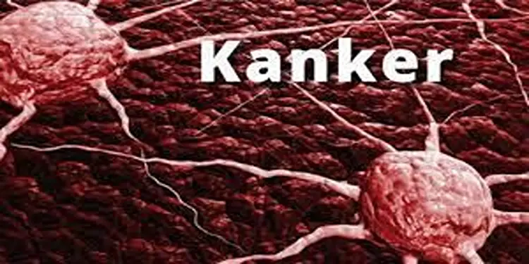 Foto: Ilustrasi ancaman kanker.(Istimewa)